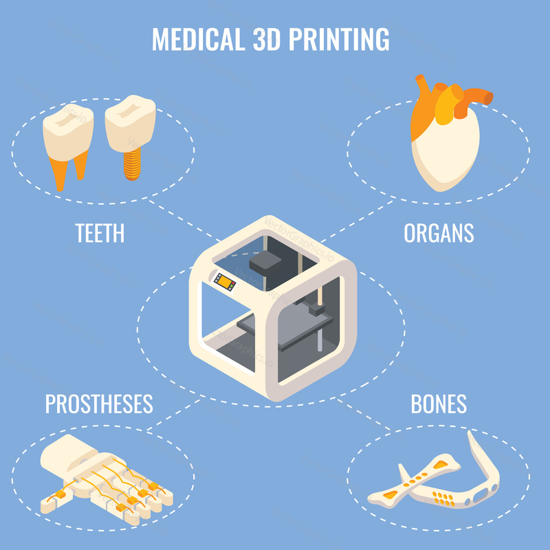 Medical 3d printing concept vector isometric illustration. Organ fabrication, creation of customized prosthetics and implants technology.