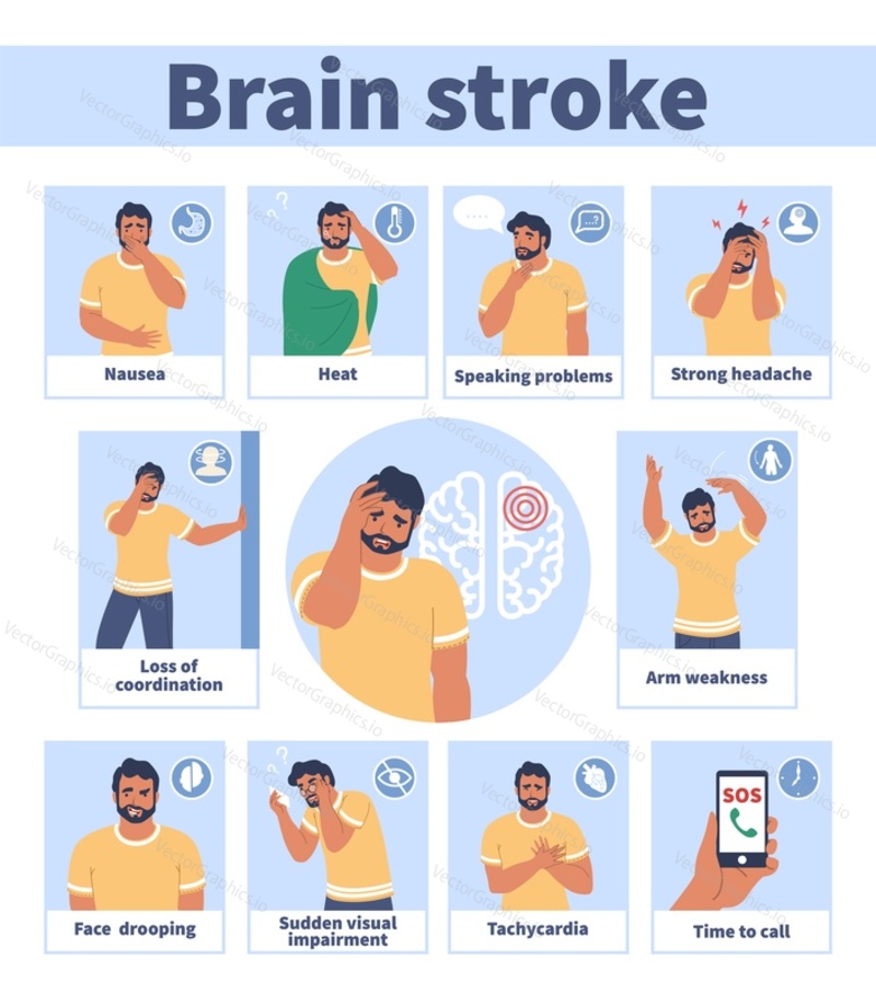 Brain stroke warning signs and symptoms vector infographic, medical poster. Patient suffering from ischemic stroke attack. Arm, leg weakness, headache, trouble seeing, speaking, face drooping.