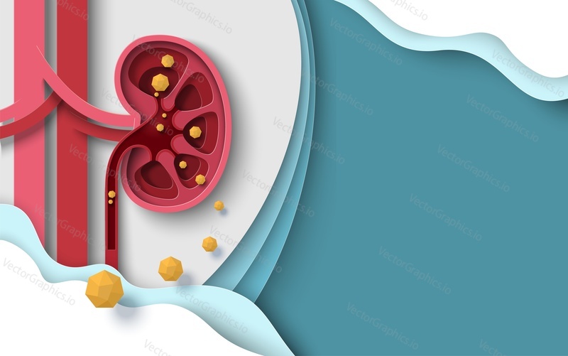 Kidney stones human renal disease vector background. Chronic infection illustration. Illness diagnosis and treatment. Internal organ disorder. Medicine and healthcare poster, banner