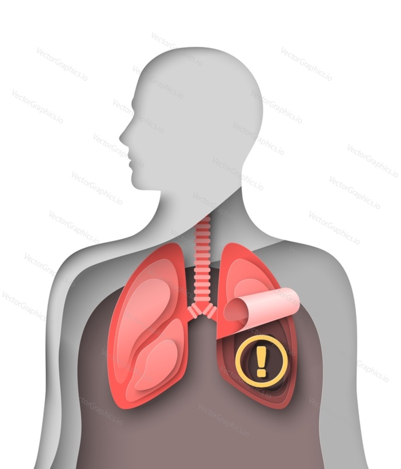 Human lung vector. Pneumonia or asthma respiratory disease awareness world day. Pulmonary medicine and healthcare. Man silhouette with breathing internal organ and examination sign paper cut style