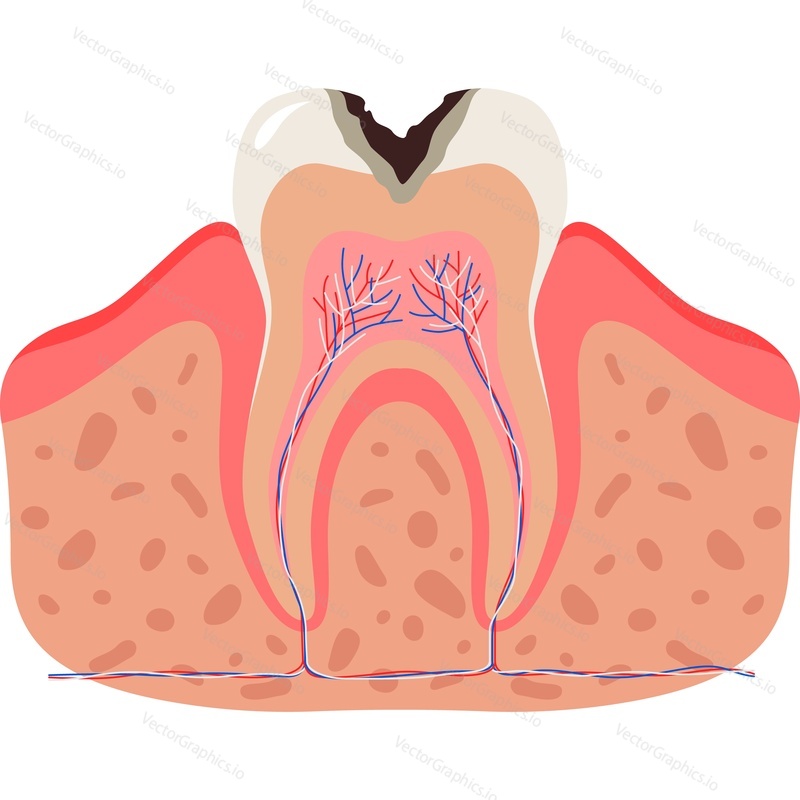 Hole in tooth, dental anatomy vector icon isolated on white background