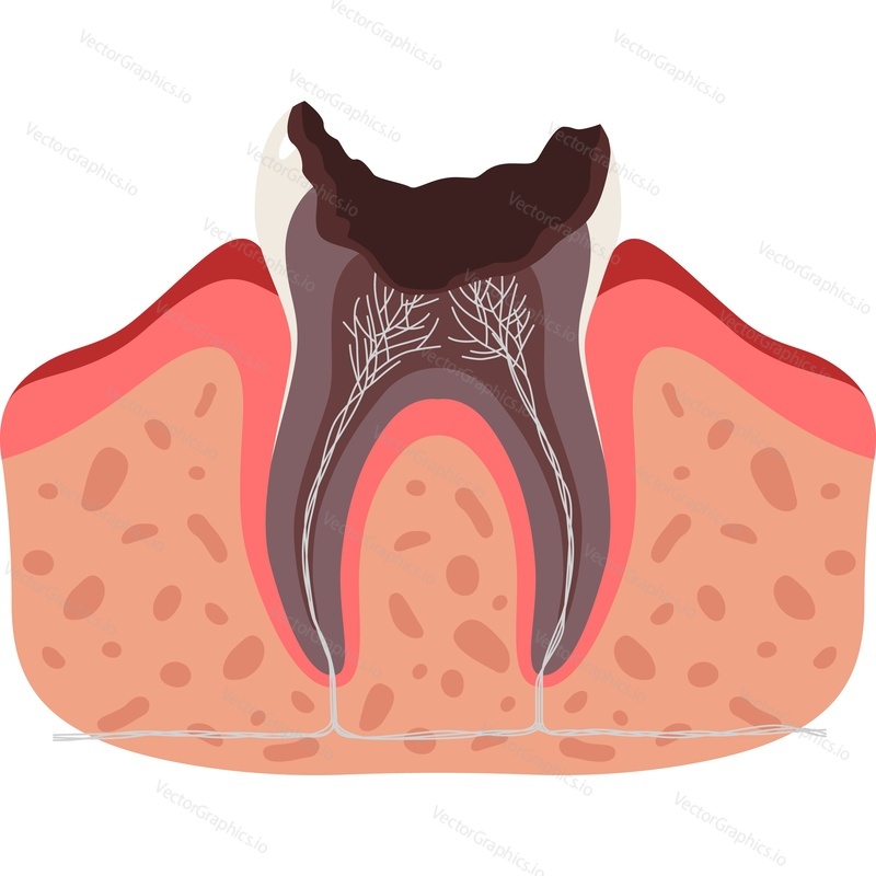 Nemocný zničil zub zubní anatomie vektorové ikony izolovaných na bílém pozadí